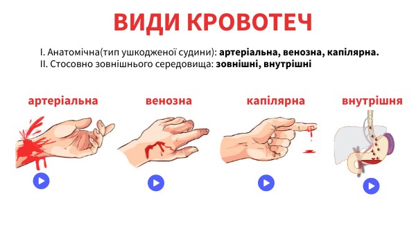 ВИДИ КРОВОТЕЧ