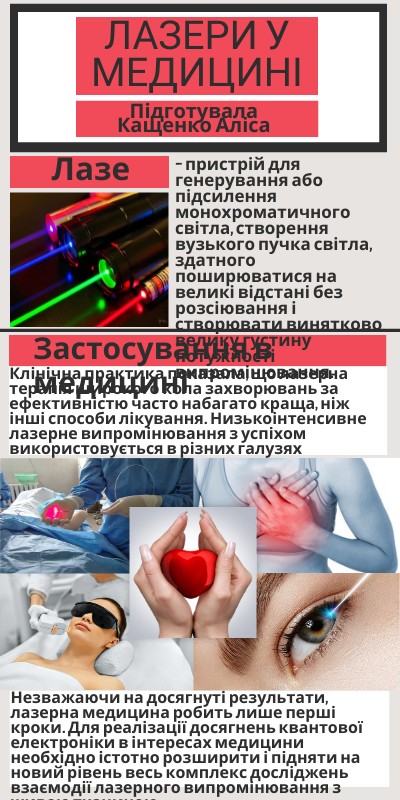 Лазери