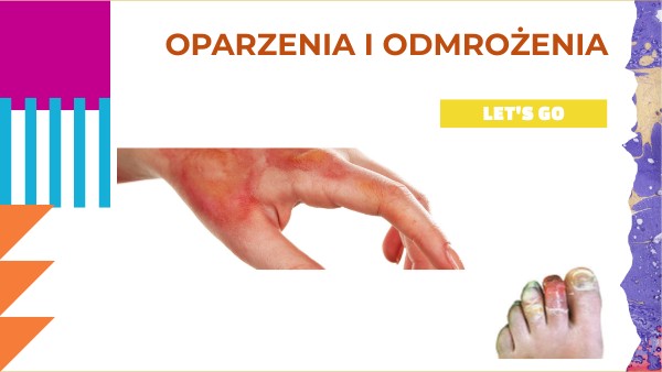 Oparzenia i odmrożenia