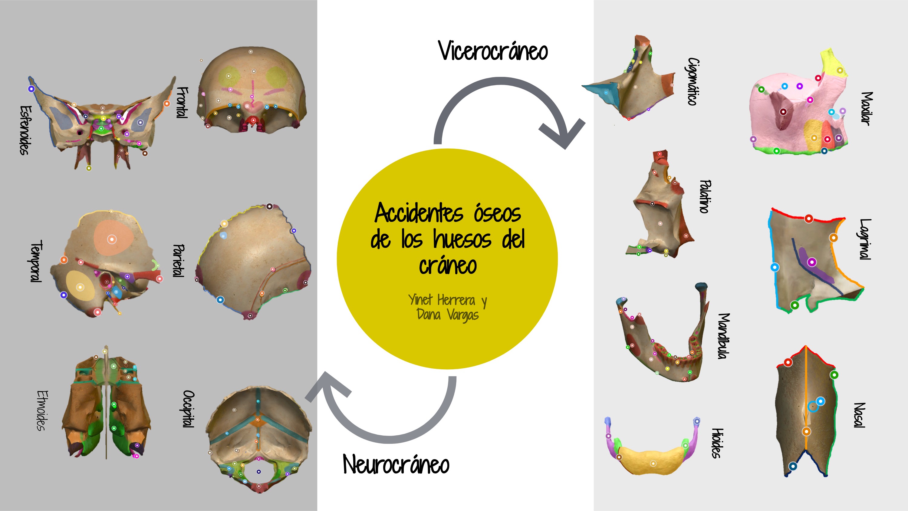Accidentes óseos de los huesos del cráneo