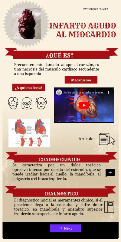 Infarto agudo al miocardio