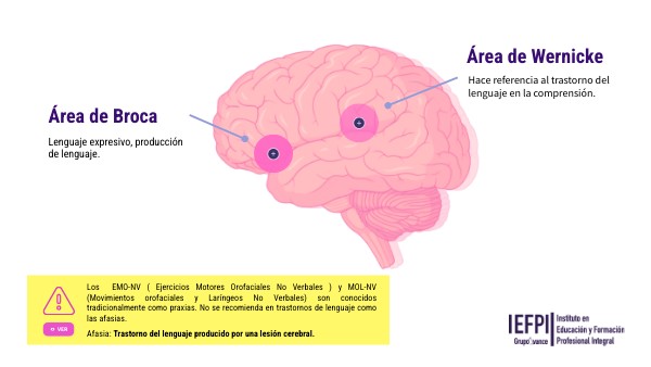 Broca y Wernicke