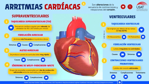 ARRITMIAS CARDÍACAS