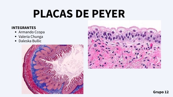 Placas De Peyer: Características, Funciones, Histología – DZED