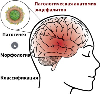 Энцефалит