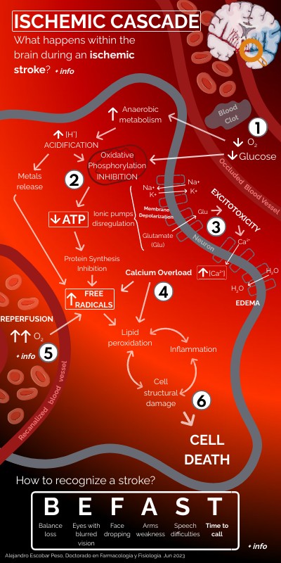 Ischemic cascade Curso Genially UAM