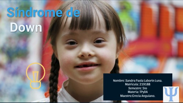 Sindrome de Down.
