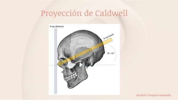 Proyección de Caldwell