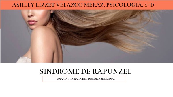 trastorno de rapunzel - Ashley Meraz